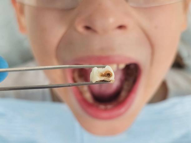 Best Broken Tooth Emergency  in Schlusser, PA